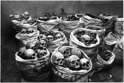 Skulls discarded after research at the Hamidia Hospital in Bhopal. Medical experts believe that the gas inhaled by the people of Bhopal may have affected the brain.